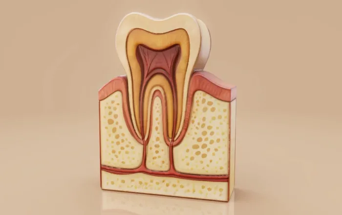 What Is Gum Disease