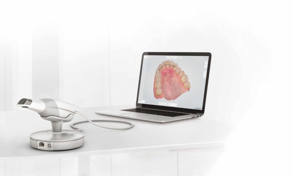 TRIOS 3 3D Scanner