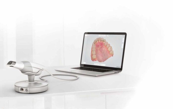 TRIOS 3 3D Scanner