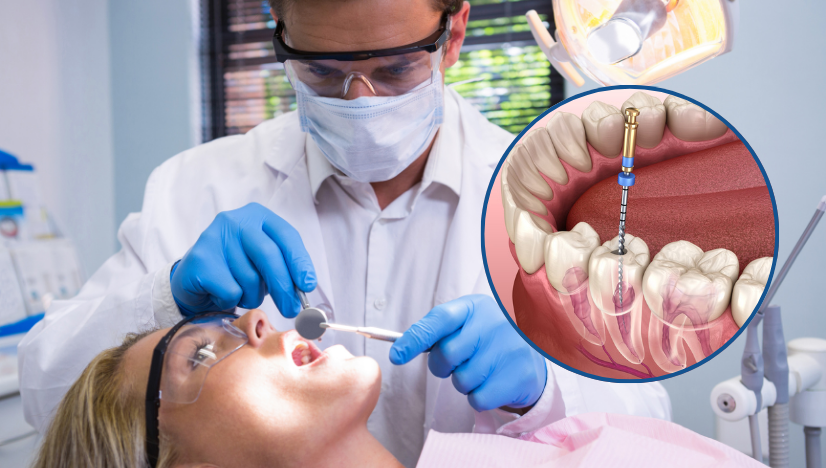 Root-Canal-Treatment-in-Emergency-Dentistry